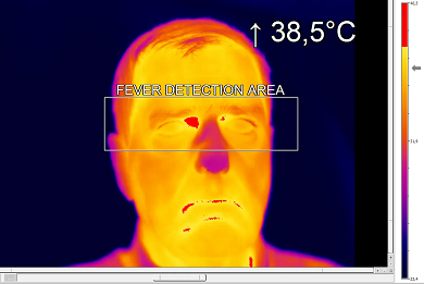 발열 선별 검사